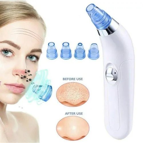Derma Suction™ Facial Cleanser – Blackhead Remover with 4 Suction Heads | Deep Pore Cleaning Tool
