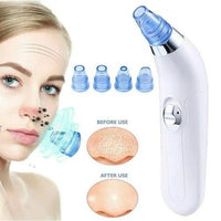 Derma Suction™ Facial Cleanser – Blackhead Remover with 4 Suction Heads | Deep Pore Cleaning Tool