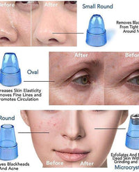 Derma Suction™ Facial Cleanser – Blackhead Remover with 4 Suction Heads | Deep Pore Cleaning Tool