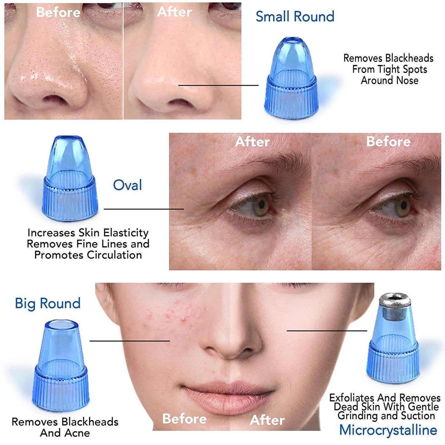 Derma Suction™ Facial Cleanser – Blackhead Remover with 4 Suction Heads | Deep Pore Cleaning Tool